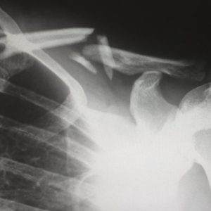 Få en grundig røntgenundersøgelse i en professionel klinik
