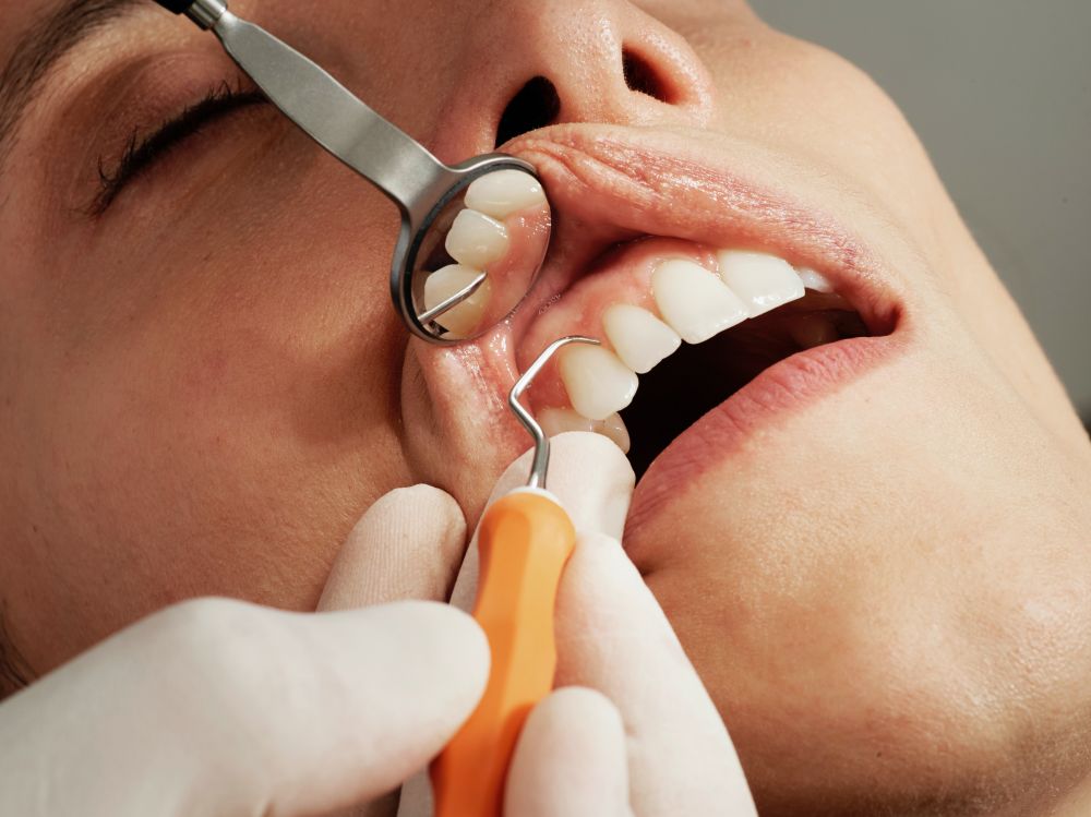 Følg disse råd når du skal finde en tandlæge i Silkeborg